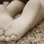 Родинки на ступнях: такие невусы необходимо удалить как можно скорее